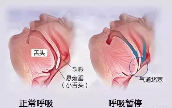 QQ截图20170825151704.jpg